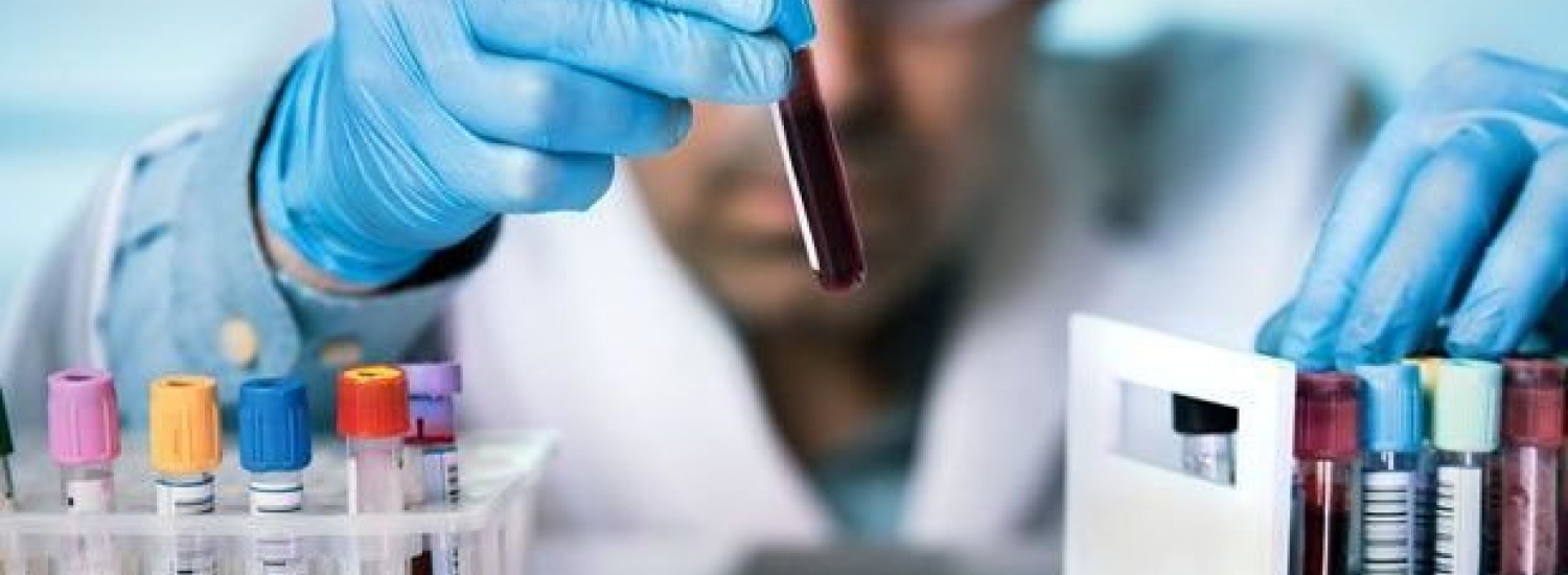 ﻿Українців масово тестуватимуть на наявність антитіл до коронавірусу