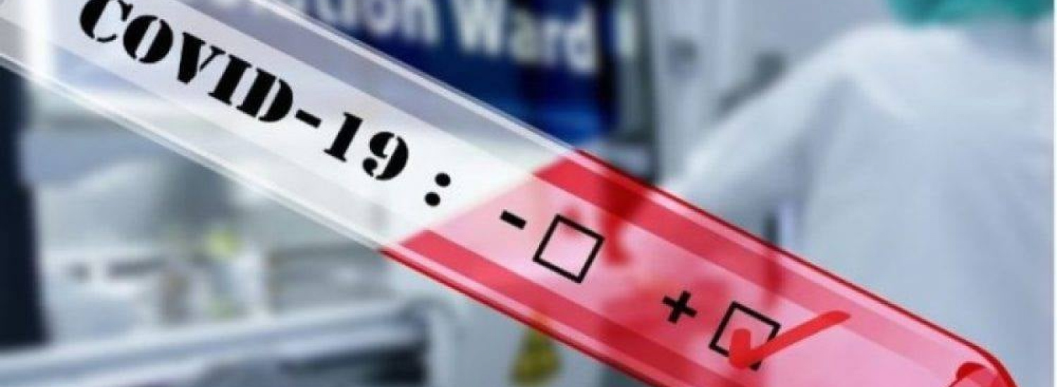 В Луганській області лабораторно підтверджено 295 нових випадків COVID-19