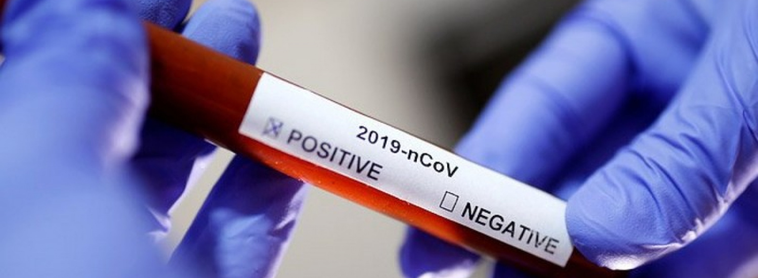 В Луганській області лабораторно підтверджено 27 нових випадків COVID-19