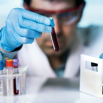 ﻿Українців масово тестуватимуть на наявність антитіл до коронавірусу